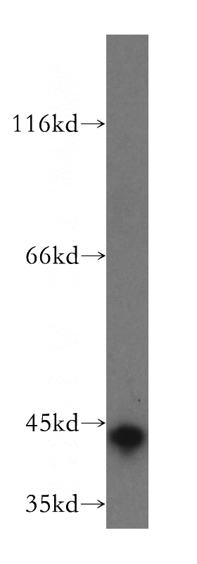 human liver tissue were subjected to SDS PAGE followed by western blot with Catalog No:115795(STX18 antibody) at dilution of 1:500