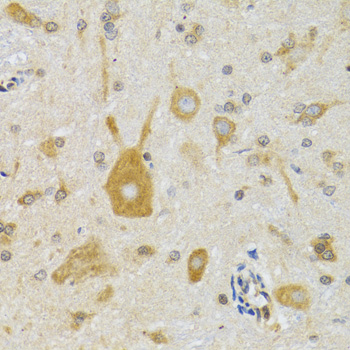 Immunohistochemistry - NEU1 Polyclonal Antibody 
