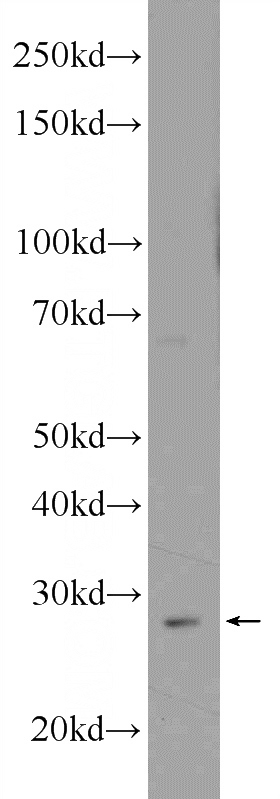 ROS1728 cells were subjected to SDS PAGE followed by western blot with Catalog No:108893(CTSK Antibody) at dilution of 1:1000