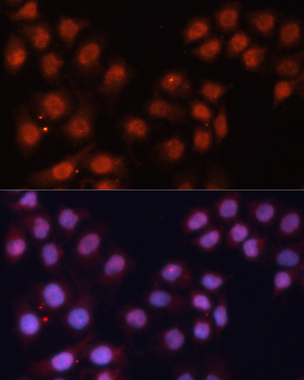 Immunofluorescence - CDK11B Polyclonal Antibody 