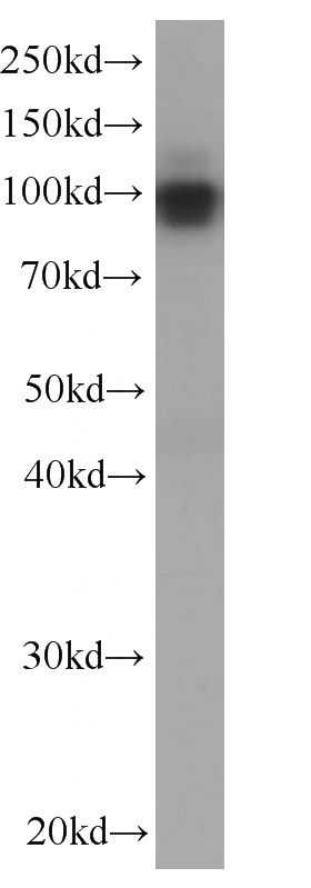pig kidney tissue were subjected to SDS PAGE followed by western blot with Catalog No:107427(MME,CD10 Antibody) at dilution of 1:1000