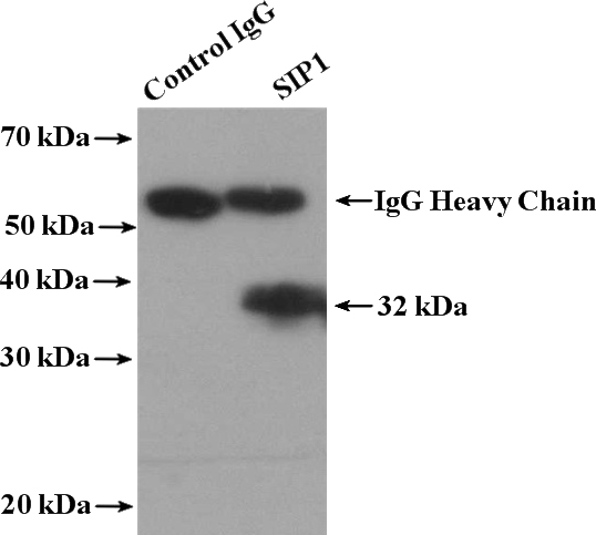 IP Result of anti-SIP1 (IP:Catalog No:115235, 4ug; Detection:Catalog No:115235 1:500) with HepG2 cells lysate 1000ug.