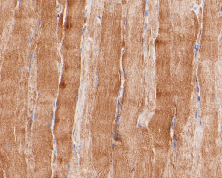 Fig3:; Immunohistochemical analysis of paraffin-embedded rat smooth muscle tissue using anti-KV2.2 antibody. The section was pre-treated using heat mediated antigen retrieval with Tris-EDTA buffer (pH 8.0-8.4) for 20 minutes.The tissues were blocked in 5% BSA for 30 minutes at room temperature, washed with ddH; 2; O and PBS, and then probed with the primary antibody ( 1/50) for 30 minutes at room temperature. The detection was performed using an HRP conjugated compact polymer system. DAB was used as the chromogen. Tissues were counterstained with hematoxylin and mounted with DPX.