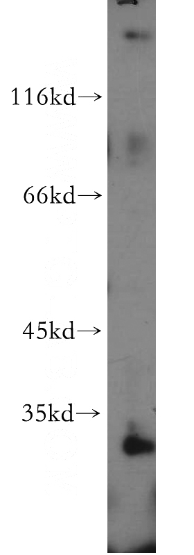 human testis tissue were subjected to SDS PAGE followed by western blot with Catalog No:111765(IL17RB antibody) at dilution of 1:300