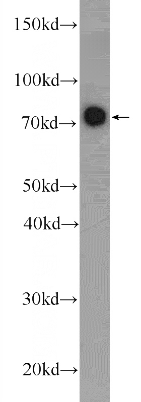 MCF-7 cells were subjected to SDS PAGE followed by western blot with Catalog No:109737(CTTNBP2NL Antibody) at dilution of 1:1000