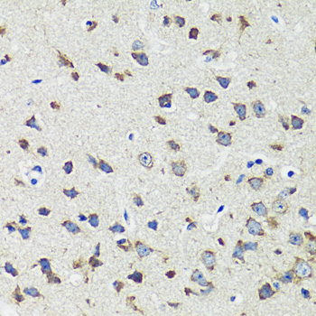 Immunohistochemistry - CCDC124 Polyclonal Antibody 