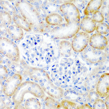 Immunohistochemistry - RLN2 Polyclonal Antibody 