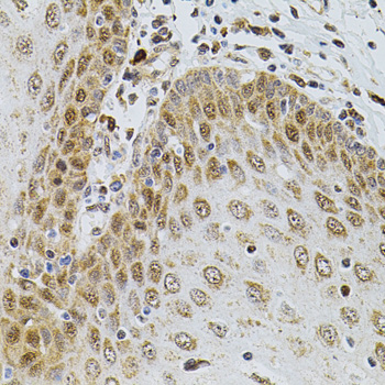 Immunohistochemistry - CDCA8 Polyclonal Antibody 