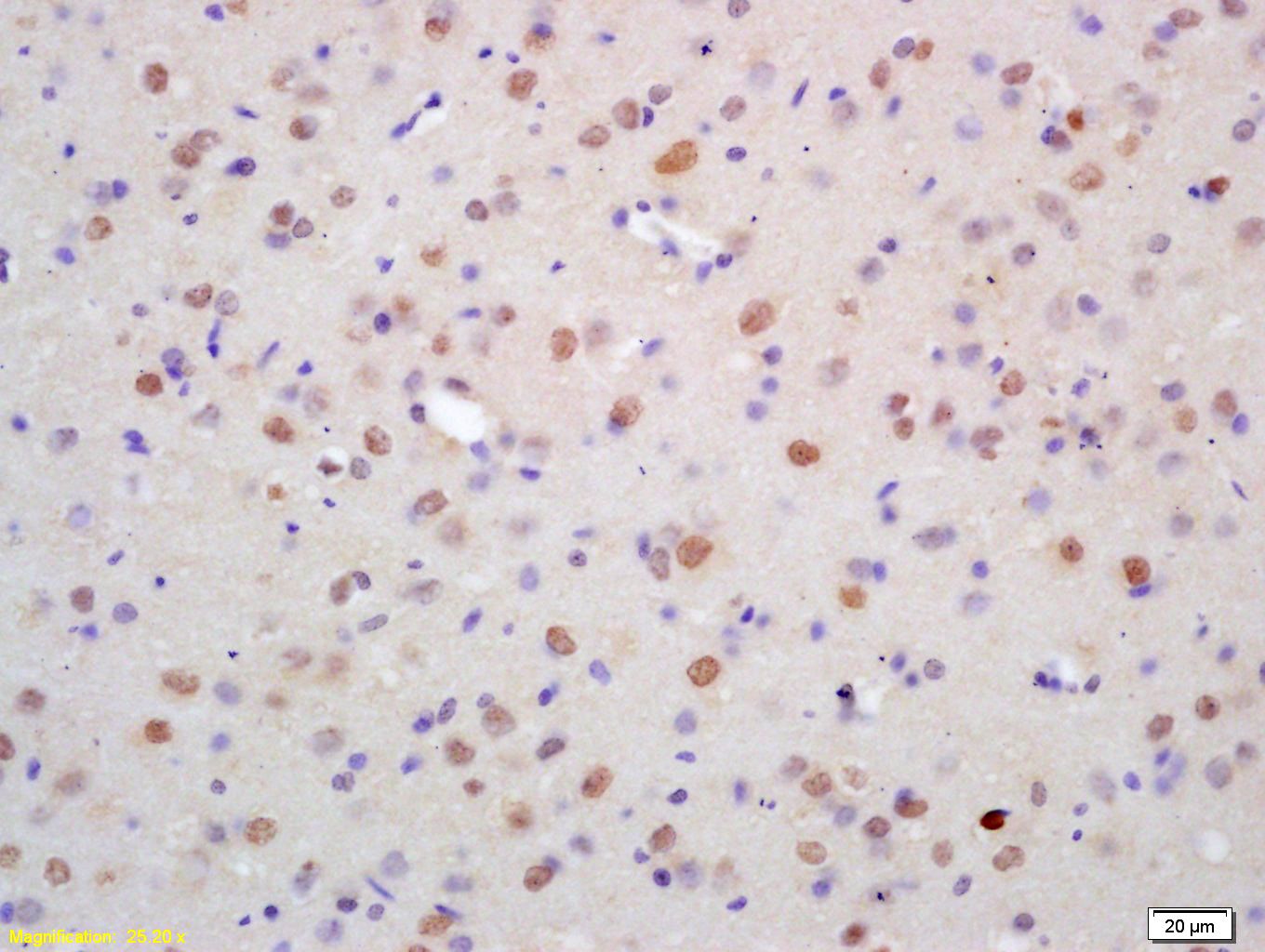 Fig1: Tissue/cell: rat brain tissue; 4% Paraformaldehyde-fixed and paraffin-embedded;; Antigen retrieval: citrate buffer ( 0.01M, pH 6.0 ), Boiling bathing for 15min; Block endogenous peroxidase by 3% Hydrogen peroxide for 30min; Blocking buffer (normal goat serum,C-0005) at 37℃ for 20 min;; Incubation: Anti-ZNF312 Polyclonal Antibody, Unconjugated 1:200, overnight at 4℃, followed by conjugation to the secondary antibody(SP-0023) and DAB(C-0010) staining