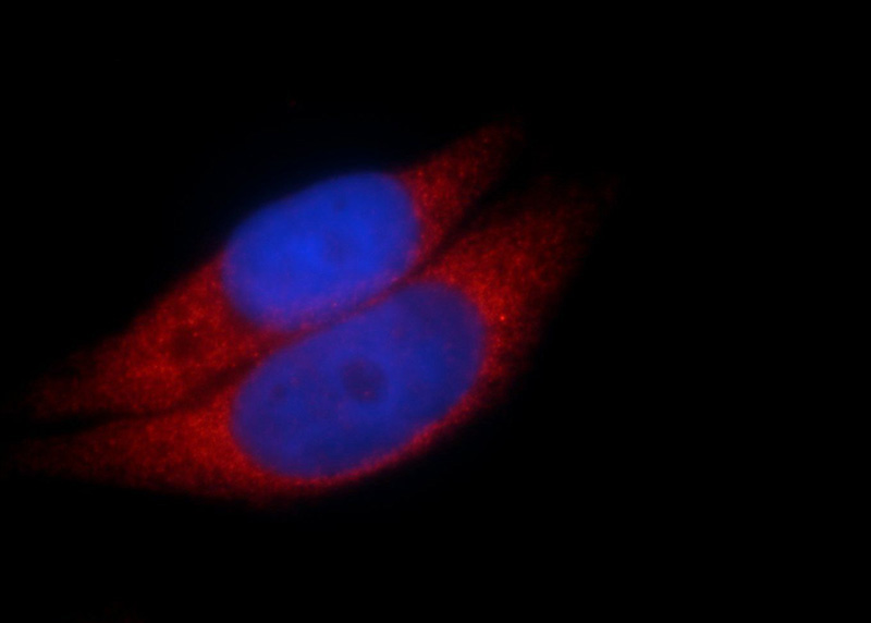 Immunofluorescent analysis of HeLa cells using Catalog No:108904(CAST Antibody) at dilution of 1:25 and Rhodamine-Goat anti-Rabbit IgG