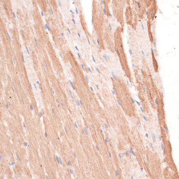 Immunohistochemistry - KIF1C Polyclonal Antibody 