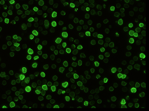 CD147 / EMMPRIN / Basigin Antibody, Rabbit MAb, Immunofluorescence