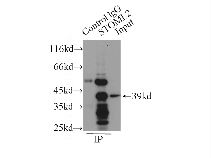 IP Result of anti-STOML2 (IP:Catalog No:115731, 3ug; Detection:Catalog No:115731 1:1000) with mouse brain tissue lysate 1000ug.