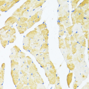 Immunohistochemistry - DDX3Y Polyclonal Antibody 