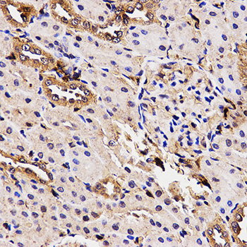 Immunohistochemistry - BCHE Polyclonal Antibody 