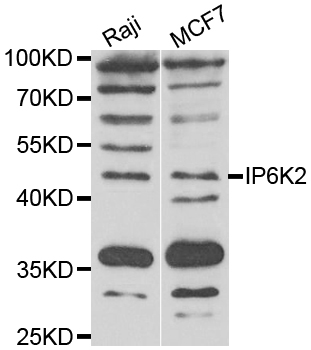 Western blot - IP6K2 Polyclonal Antibody 