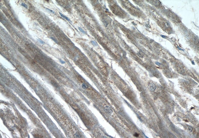 Immunohistochemistry of paraffin-embedded human heart tissue slide using Catalog No:116583(USHBP1 Antibody) at dilution of 1:50 (under 40x lens)