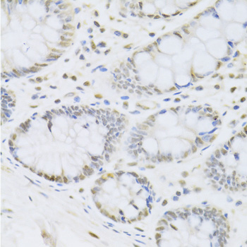 Immunohistochemistry - CBX8 Polyclonal Antibody 