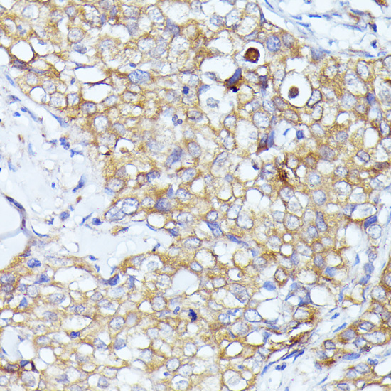 Immunohistochemistry - EIF3L Polyclonal Antibody 