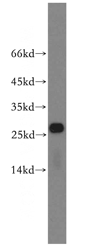 mouse liver tissue were subjected to SDS PAGE followed by western blot with Catalog No:114916(RPS8 antibody) at dilution of 1:600