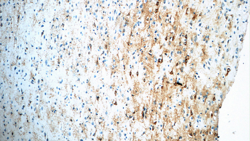 Immunohistochemistry of paraffin-embedded human brain tissue slide using Catalog No:112058(KCNJ2 Antibody) at dilution of 1:50