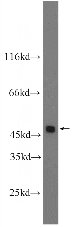 Jurkat cells were subjected to SDS PAGE followed by western blot with Catalog No:110012(DR4 antibody) at dilution of 1:1000