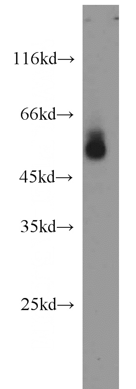 human blood tissue were subjected to SDS PAGE followed by western blot with Catalog No:108038(APOH antibody) at dilution of 1:1000