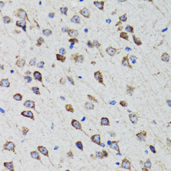 Immunohistochemistry - HEXA Polyclonal Antibody 
