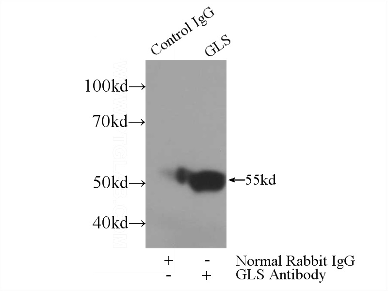 IP Result of anti-GAC-specific (IP:Catalog No:110815, 3ug; Detection:Catalog No:110815 1:500) with mouse kidney tissue lysate 4000ug.