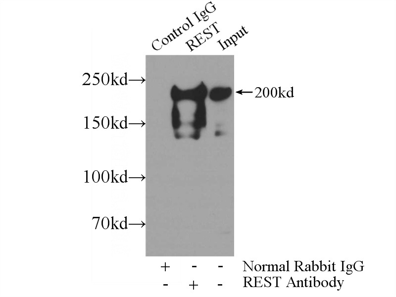 IP Result of anti-REST (IP:Catalog No:114693, 5ug; Detection:Catalog No:114693 1:1000) with HeLa cells lysate 2720ug.