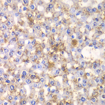 Immunohistochemistry - HAPLN1 Polyclonal Antibody 