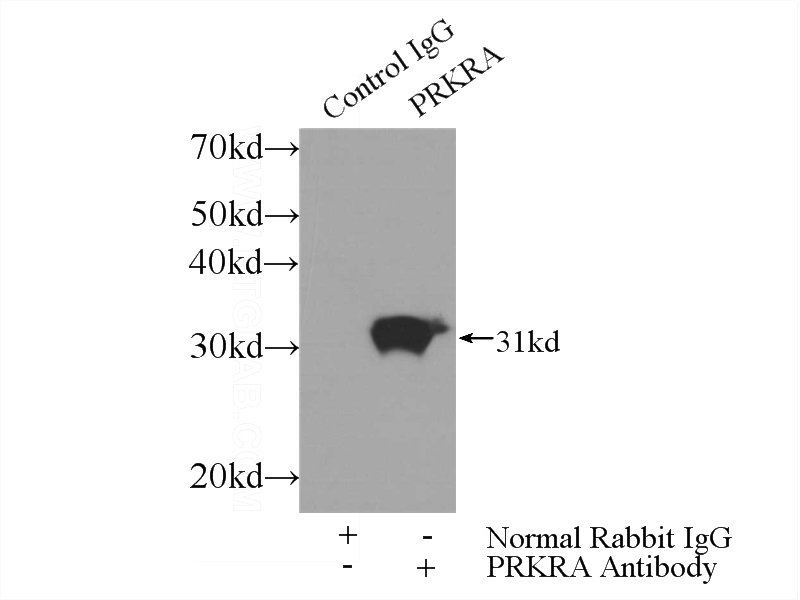 IP Result of anti-PRKRA (IP:Catalog No:113481, 3ug; Detection:Catalog No:113481 1:700) with mouse testis tissue lysate 4000ug.