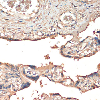 Immunohistochemistry - MST1 Polyclonal Antibody 