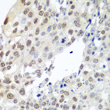 Immunohistochemistry - PTTG1 Polyclonal Antibody 