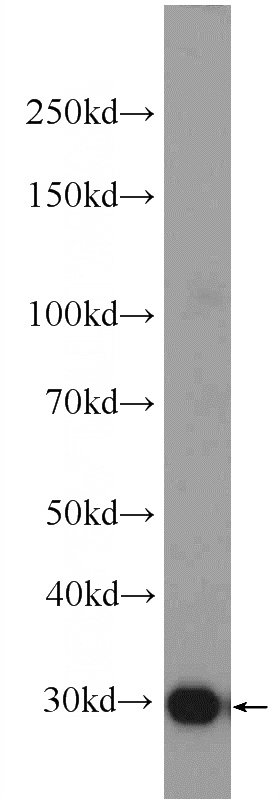 mouse brain tissue were subjected to SDS PAGE followed by western blot with Catalog No:110166(MAPRE3 Antibody) at dilution of 1:1000
