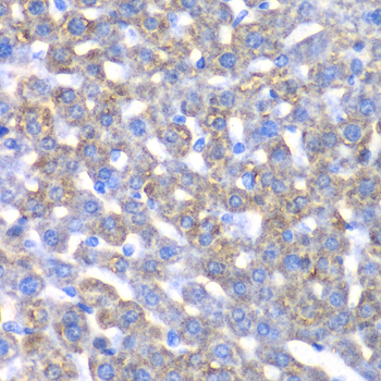 Immunohistochemistry - CCBL1 Polyclonal Antibody 
