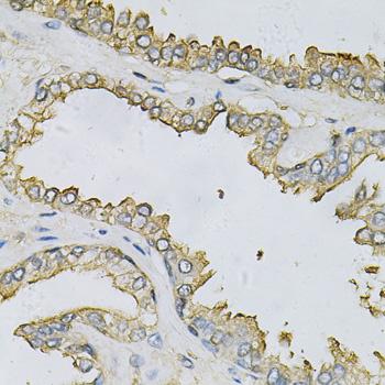 Immunohistochemistry - APRT Polyclonal Antibody 
