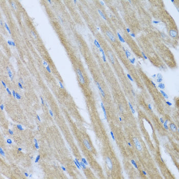 Immunohistochemistry - CCM2 Polyclonal Antibody 