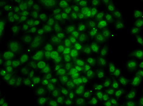 Immunofluorescence - ATMIN Polyclonal Antibody 