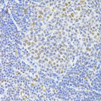Immunohistochemistry - SNRNP70 Polyclonal Antibody 