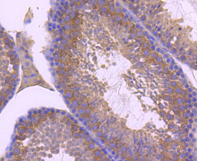 Fig1:; Immunohistochemical analysis of paraffin-embedded mouse testis tissue using anti-ZNRF2 antibody. The section was pre-treated using heat mediated antigen retrieval with Tris-EDTA buffer (pH 9.0) for 20 minutes.The tissues were blocked in 1% BSA for 30 minutes at room temperature, washed with ddH; 2; O and PBS, and then probed with the primary antibody ( 1/50) for 30 minutes at room temperature. The detection was performed using an HRP conjugated compact polymer system. DAB was used as the chromogen. Tissues were counterstained with hematoxylin and mounted with DPX.