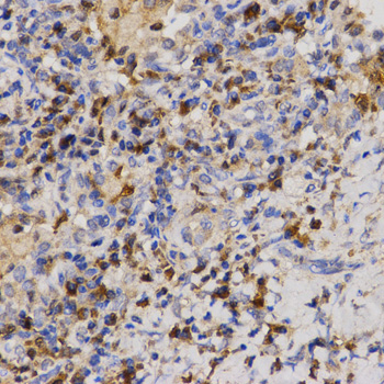 Immunohistochemistry - Eif2ak2 Polyclonal Antibody 