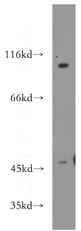 mouse heart tissue were subjected to SDS PAGE followed by western blot with Catalog No:114689(REN antibody) at dilution of 1:300
