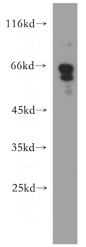 Jurkat cells were subjected to SDS PAGE followed by western blot with Catalog No:109229(CHEK2 antibody) at dilution of 1:500