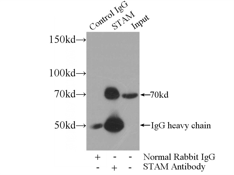 IP Result of anti-STAM (IP:Catalog No:115672, 4ug; Detection:Catalog No:115672 1:300) with PC-3 cells lysate 1440ug.