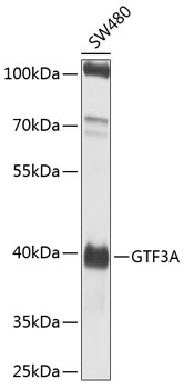 Western blot - GTF3A Polyclonal Antibody 