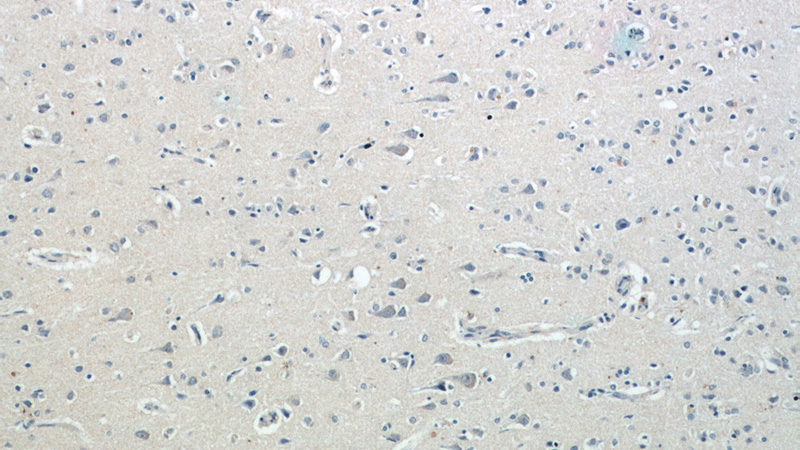Immunohistochemical of paraffin-embedded human brain using Catalog No:107331(NF200 antibody) at dilution of 1:50 (under 10x lens)