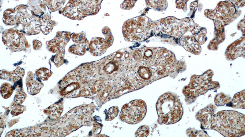 Immunohistochemical of paraffin-embedded human placenta using Catalog No:116735(VEGFA antibody) at dilution of 1:50 (under 10x lens)