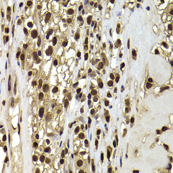 Immunohistochemistry - ACTL6B Polyclonal Antibody 