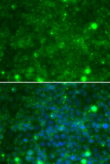Immunofluorescence - TIMP3 Polyclonal Antibody 